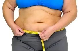 Ilustración sobre medición de la circunferencia abdominal y obesidad